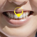 OsAX